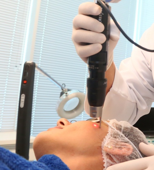 Tratamento de acne - Clinica Ricardo Fenelon - Brasília/DF